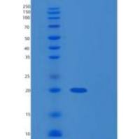 人RNF181重组蛋白