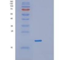人RPL12重组蛋白