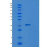 人RAB6B重组蛋白