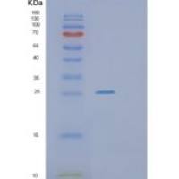 人Ras同源基因家族成员A(RHOA)重组蛋白