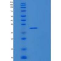 人RPL7A重组蛋白