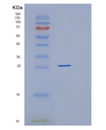 人RAB27A重组蛋白