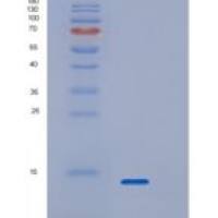 人RPAIN重组蛋白