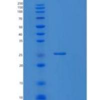 人RAB5C重组蛋白