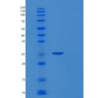 人RAS癌基因家族成员RAB7A(RAB7A)重组蛋白