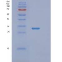 人RASD2重组蛋白