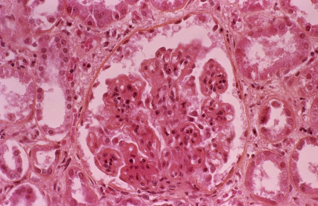 一文详解 | 系统性红斑狼疮动物模型