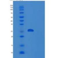 人RNA核酸外切酶2同源物(REXO2)重组蛋白