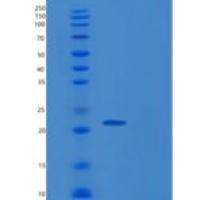 人RAP1A重组蛋白