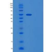 人RNMTL1重组蛋白