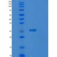 人RAB5B重组蛋白