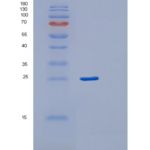 人RAB24重组蛋白