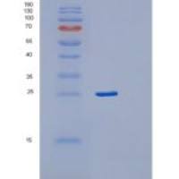 人RAB24重组蛋白