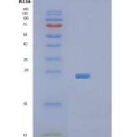 人蛋白信号调节因子5(RGS5)重组蛋白