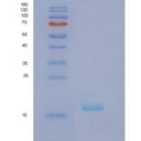 人视黄醇结合蛋白7(RBP7)重组蛋白