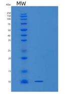 人受体活性修饰蛋白1(RAMP1)重组蛋白