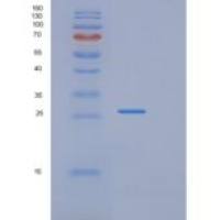 人RAB2B重组蛋白