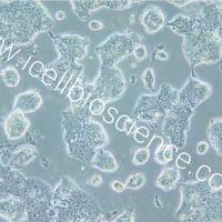 NCI-H508 人结肠直肠腺癌细胞/STR鉴定/镜像绮点(Cellverse)