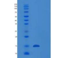 人RABIF重组蛋白