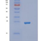 人视黄醇结合蛋白1(RBP1)重组蛋白
