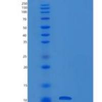 人抵抗素(RETN)重组蛋白