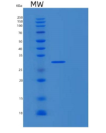 人RPL7A重组蛋白
