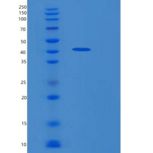 人环指蛋白34(RNF34)重组蛋白