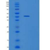 人环指蛋白34(RNF34)重组蛋白