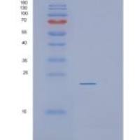 人蛋白信号调节因子10(RGS10)重组蛋白