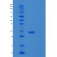 人RAS癌基因家族成员RAB5A(RAB5A)重组蛋白