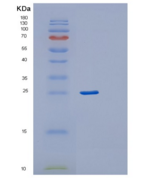 人RAB24重组蛋白