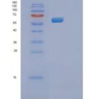 人蛋白信号调节因子14(RGS14)重组蛋白