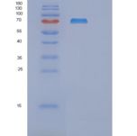 人mRNA-capping enzyme (RNGTT)重组蛋白