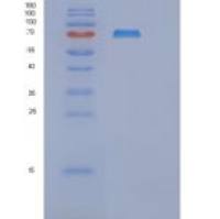 人mRNA-capping enzyme (RNGTT)重组蛋白