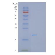 人蛋白信号调节因子21(RGS21)重组蛋白