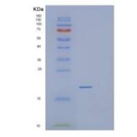 人蛋白信号调节因子21(RGS21)重组蛋白