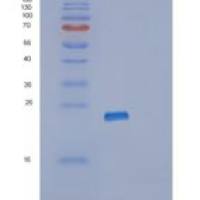 人RPL11重组蛋白