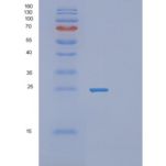 人V-Ral猴白血病病毒癌基因同源物A(RALA)重组蛋白