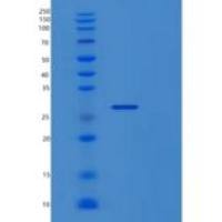 人蛋白信号调节因子19(RGS19)重组蛋白