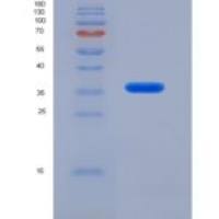 人核糖核酸酶H2亚基A(RNASEH2A)重组蛋白
