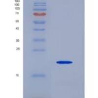 人再生胰岛衍生蛋白4(REG4)重组蛋白