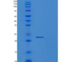 人RAD51D iso4重组蛋白