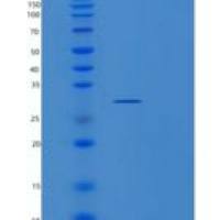 人维甲酸受体应答基因1(RARRES1)重组蛋白