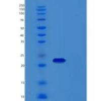 人Recoverin重组蛋白