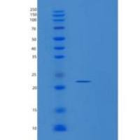 人RANGRF重组蛋白