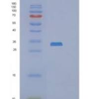 人RASL12重组蛋白