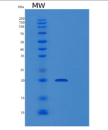 人松弛肽2(RLN2)重组蛋白