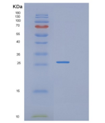 人RAB2B重组蛋白