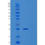 人松弛肽2(RLN2)重组蛋白