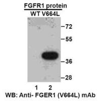 FGFR1(V664L)